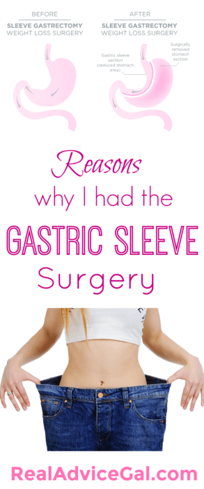 Why I had the Gastric Sleeve Surgery