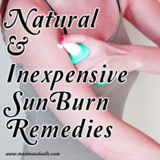 Natural Sunburn Remedies