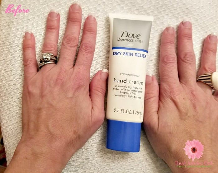 Give those dry, dull hand some love with Dove Derma hand cream.